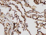 S100A4 Polyclonal Antibody Host Rabbit
