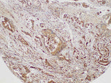 S100A4 Polyclonal Antibody Host Rabbit