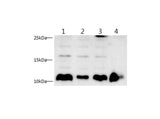 S100A4 Polyclonal Antibody Host Rabbit