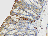 S100A4 Polyclonal Antibody Host Rabbit