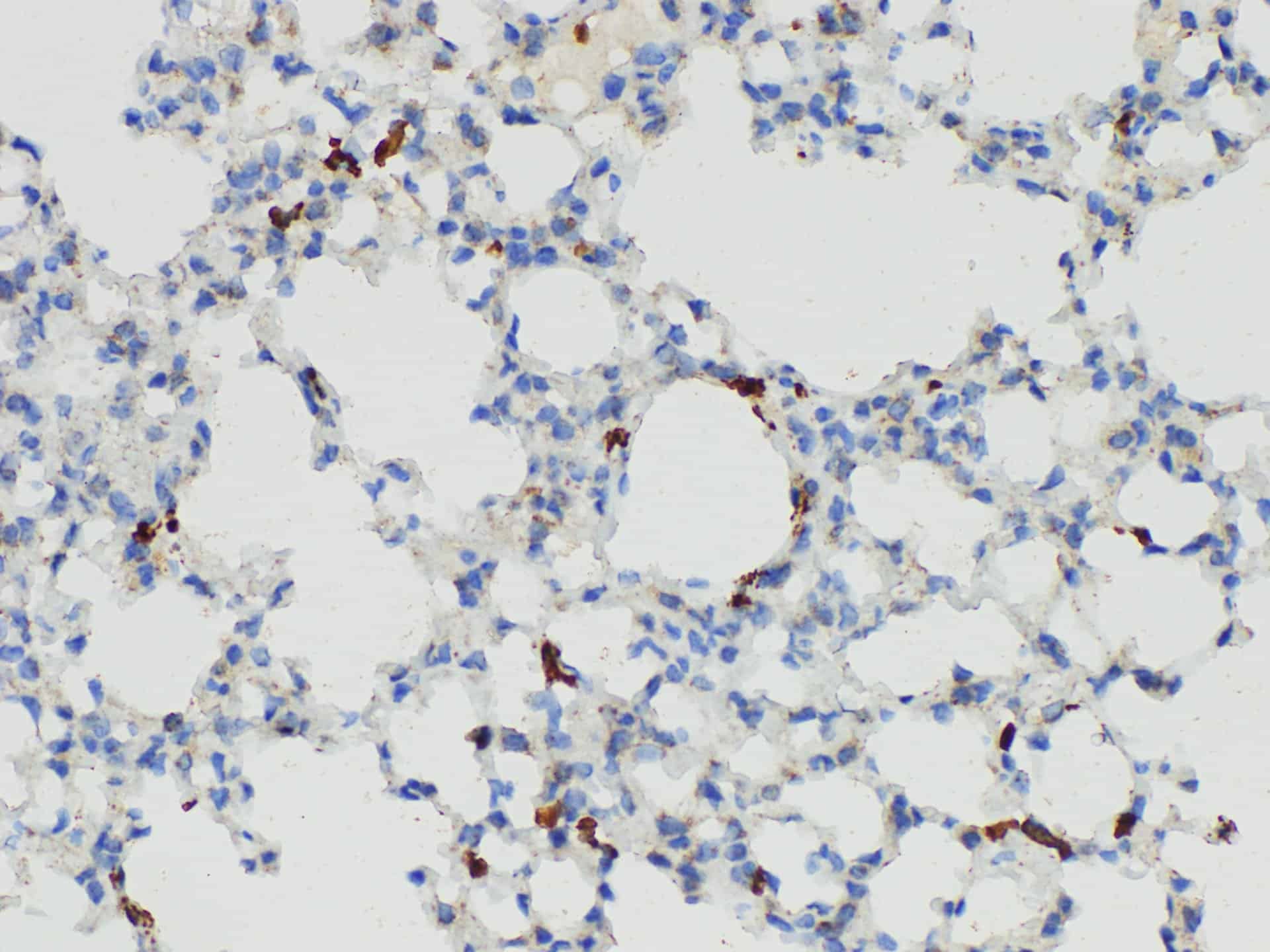 S100A4 Polyclonal Antibody Host Rabbit