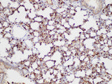 S100A4 Polyclonal Antibody Host Rabbit