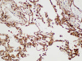 S100A4 Polyclonal Antibody Host Rabbit