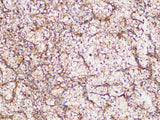 GPNMB Polyclonal Antibody Host Rabbit