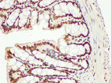 NPM1 Polyclonal Antibody