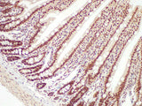 NPM1 Polyclonal Antibody