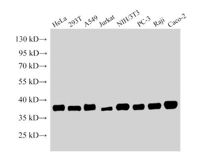 NPM1 Polyclonal Antibody