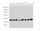 NPM1 Polyclonal Antibody