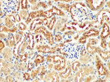 Angiotensinogen Polyclonal Antibody