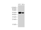 CK14 Polyclonal Antibody