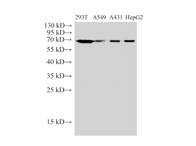 HSP70 Polyclonal Antibody Reactivity Human
