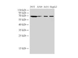 HSP70 Polyclonal Antibody Reactivity Human
