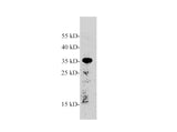 AMBP Polyclonal Antibody Reactivity Human, Zebrafish