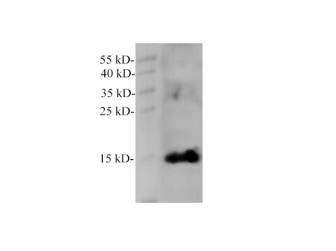 MB Polyclonal Antibody Reactivity Human