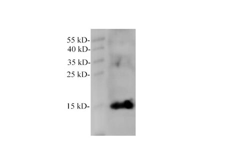 MB Polyclonal Antibody Reactivity Human
