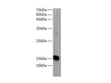 MB Polyclonal Antibody Reactivity Human