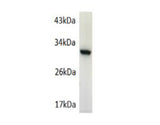 GFP Polyclonal Antibody