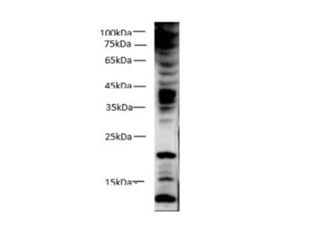 PCNA Polyclonal Antibody Reactivity Mouse