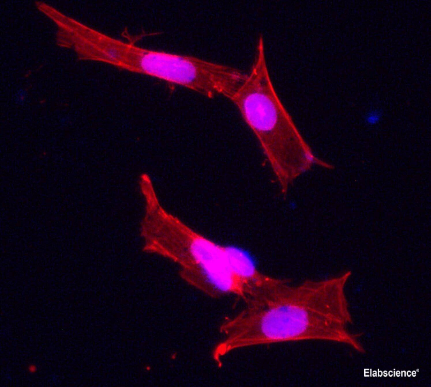 beta actin Polyclonal Antibody Reactivity Human
