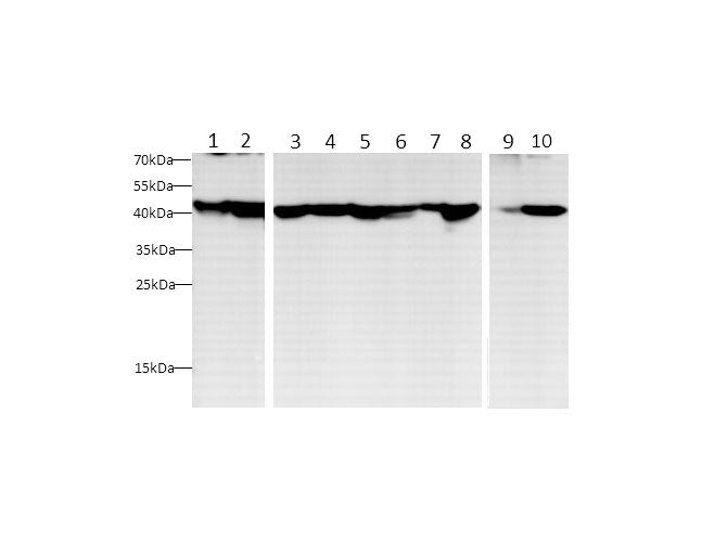 beta actin Polyclonal Antibody Reactivity Human
