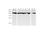 beta actin Polyclonal Antibody Reactivity Human