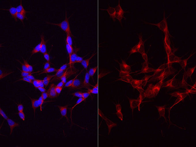 beta Tubulin Polyclonal Antibody Reactivity Mouse