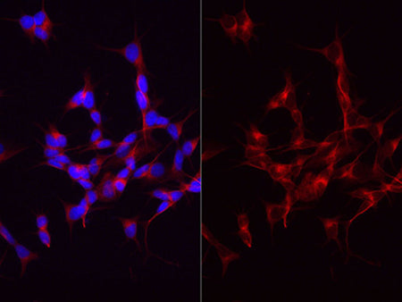 beta Tubulin Polyclonal Antibody Reactivity Mouse
