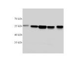 beta Tubulin Polyclonal Antibody Reactivity Mouse