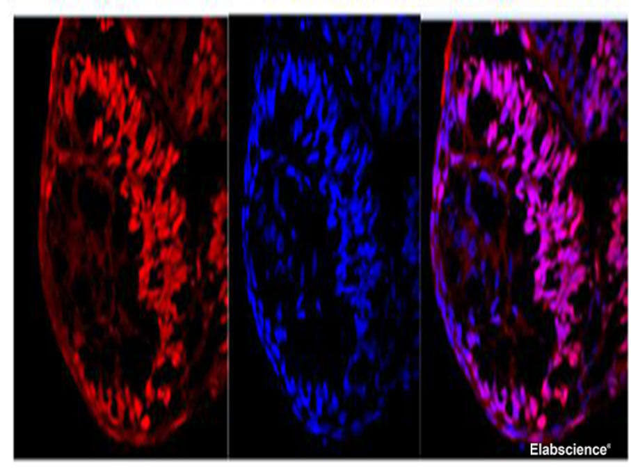 Ki67 Polyclonal Antibody Host Rabbit