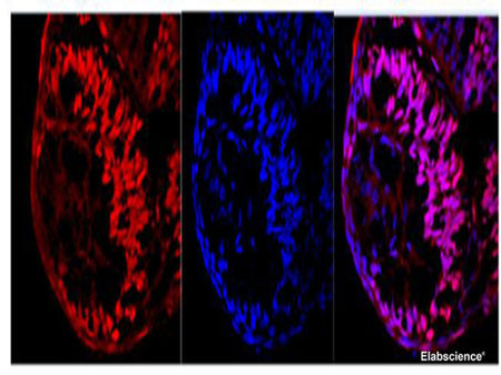 Ki67 Polyclonal Antibody Host Rabbit