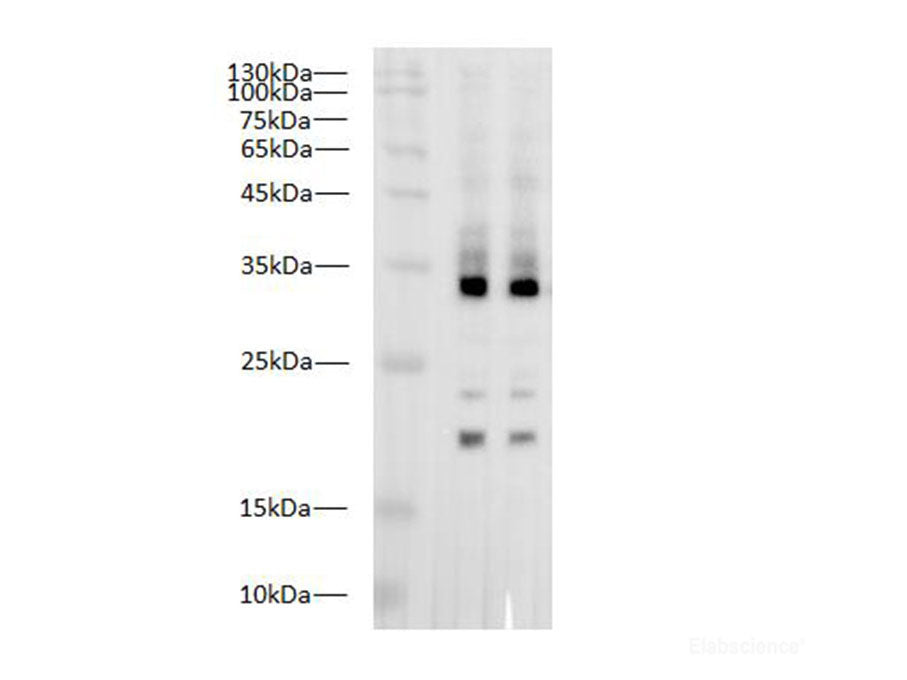 IL1 beta Polyclonal Antibody
