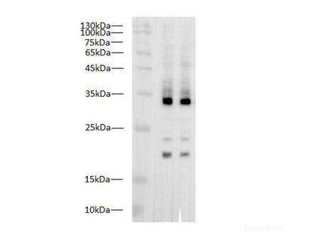 IL1 beta Polyclonal Antibody