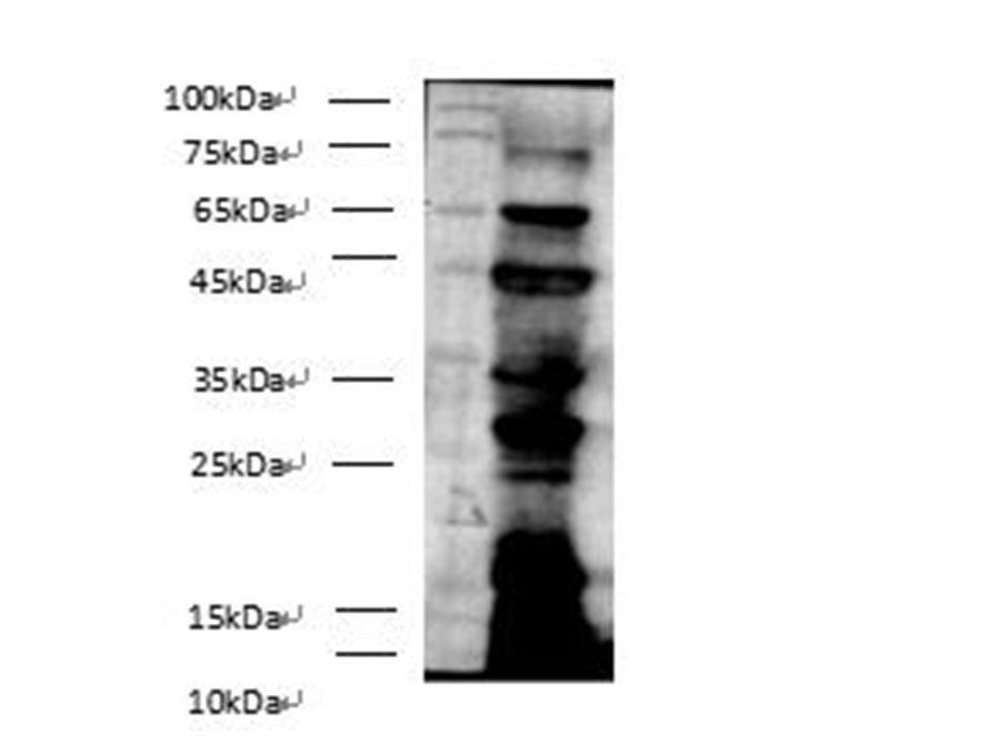 Pan Acetyl-Lysine Polyclonal Antibody