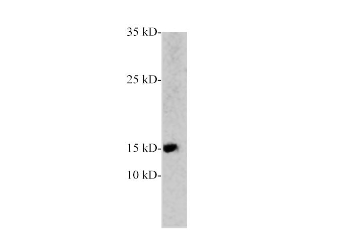 PCT Polyclonal Antibody