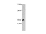PCT Polyclonal Antibody