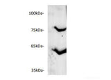 ANGPTL3 Polyclonal Antibody