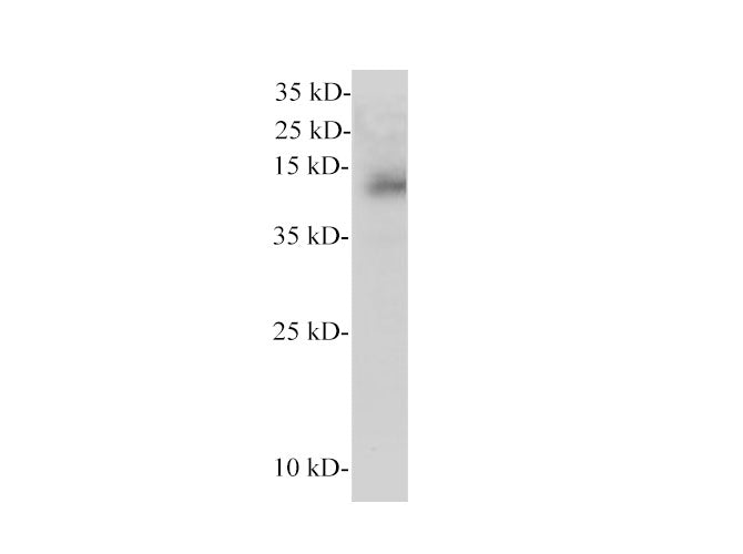 CEPT1 Polyclonal Antibody - Biomarkers - Elabscience Biotechnology - MSE Supplies