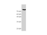 Gelsolin Polyclonal Antibody Reactivity Mouse