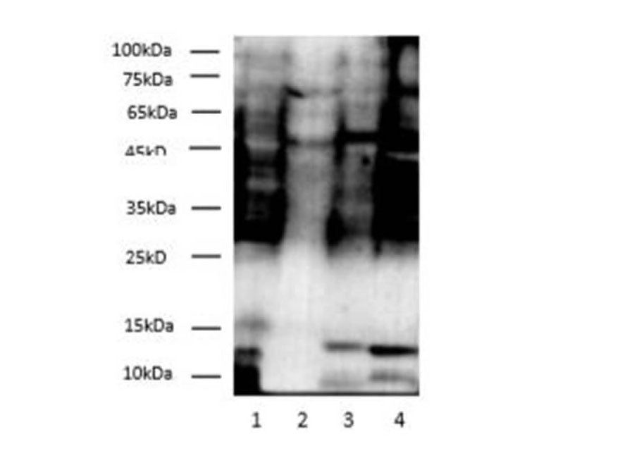 Dimethyl-Lysine Polyclonal Antibody