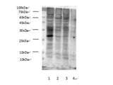 Succinylated Lysine Polyclonal Antibody