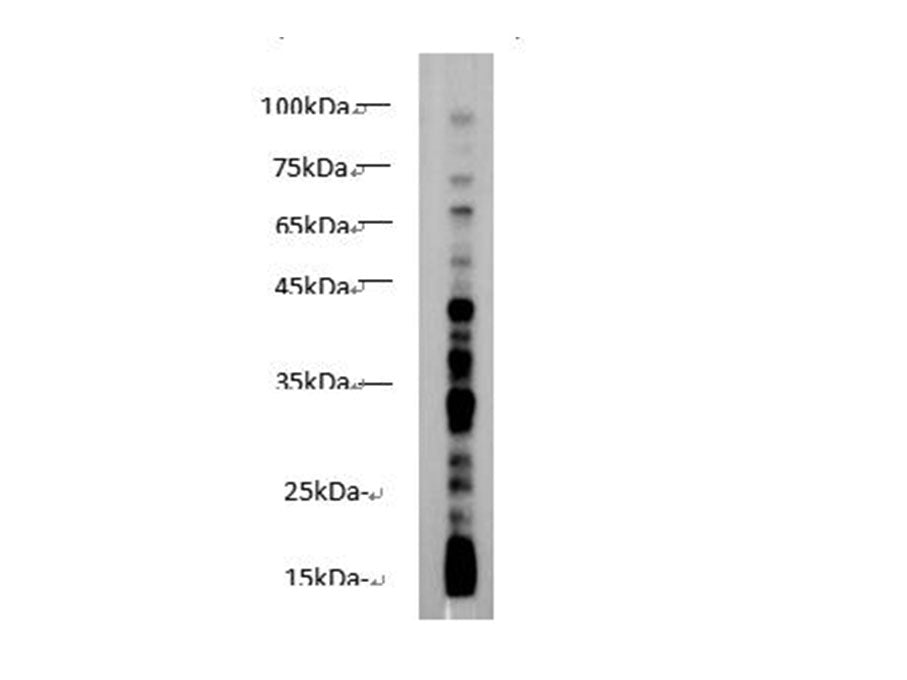 Butyryl Lysine Polyclonal Antibody