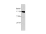 EPT1 Polyclonal Antibody