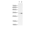 TRX Tag Polyclonal Antibody