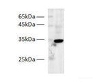 Zebrafish PPP1R3G Polyclonal Antibody
