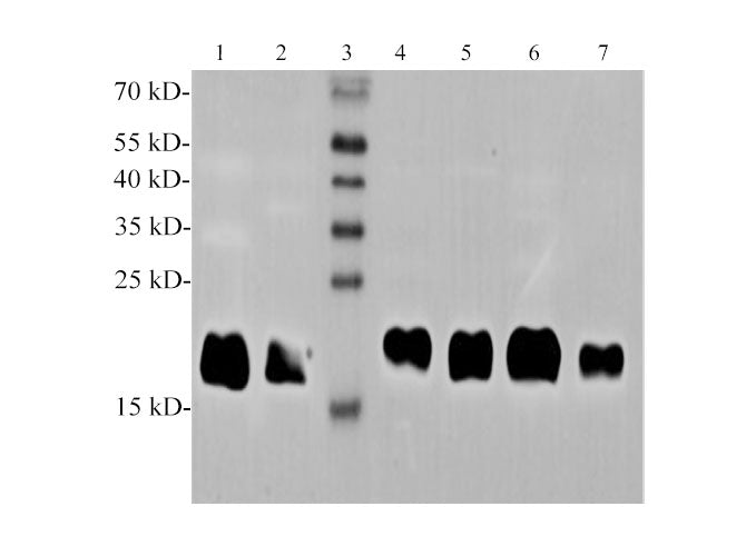 Ferritin Polyclonal Antibody