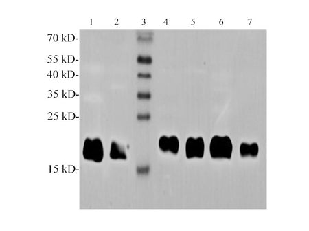 Ferritin Polyclonal Antibody
