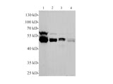 PBEF/NAMPT Polyclonal Antibody