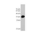GDF15 Polyclonal Antibody Reactivity Human