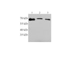 Tyrosine hydroxylase Polyclonal Antibody