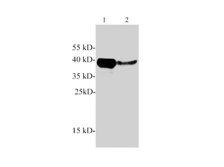 Arginase 1 Polyclonal Antibody